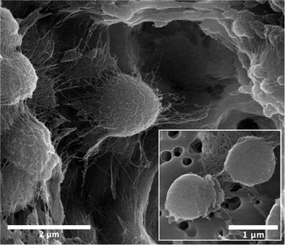 Description of Chloramphenicol Resistant Kineococcus rubinsiae sp. nov. Isolated From a Spacecraft Assembly Facility